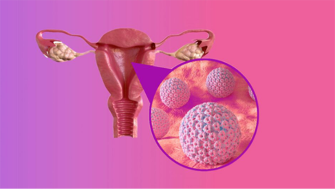 Hiểu đúng về HPV týp 16: nguy cơ đối với sức khỏe và cách dự phòng